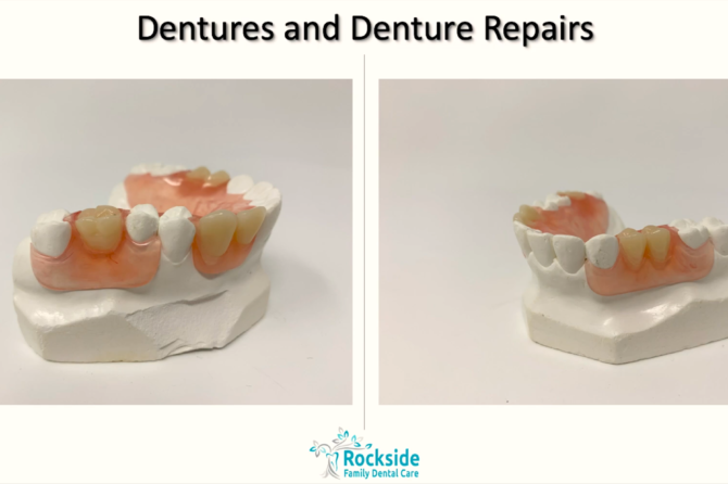 Dentures and Denture Repairs in Cleveland, Ohio